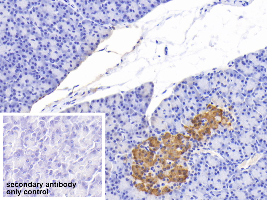 Polyclonal Antibody to C-Peptide (CP)