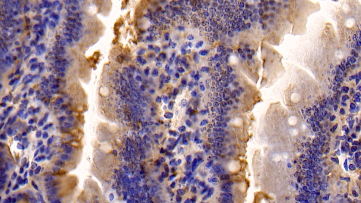 Polyclonal Antibody to Caspase 7 (CASP7)