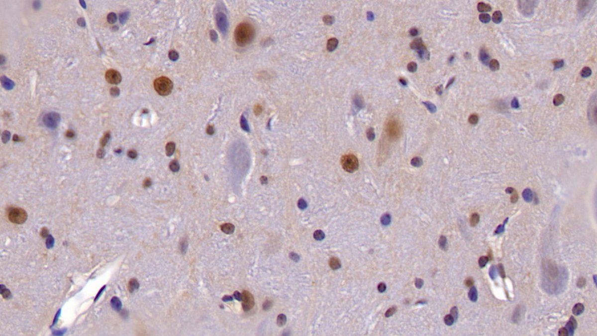 Polyclonal Antibody to Caspase 14 (CASP14)