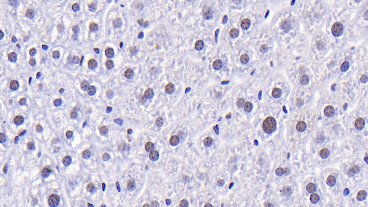 Polyclonal Antibody to Caspase 14 (CASP14)