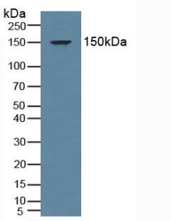 Polyclonal Antibody to Mineralocorticoid Receptor (MR)