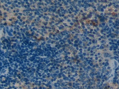 Polyclonal Antibody to Osteocalcin (OC)