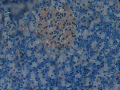 Polyclonal Antibody to Osteocalcin (OC)