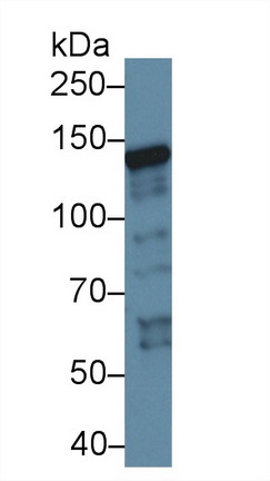 Polyclonal Antibody to Xeroderma Pigmentosum, Complementation Group C (XPC)