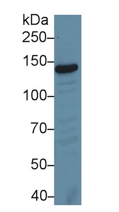 Polyclonal Antibody to Xeroderma Pigmentosum, Complementation Group C (XPC)