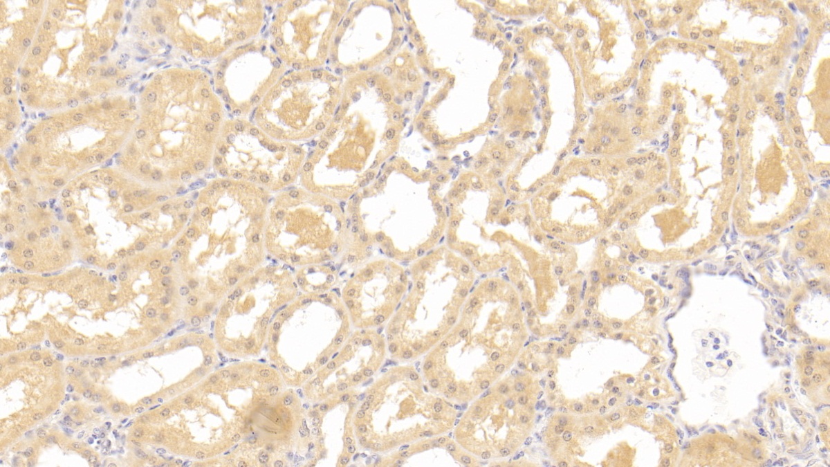 Polyclonal Antibody to Parathyroid Hormone Receptor 2 (PTHR2)