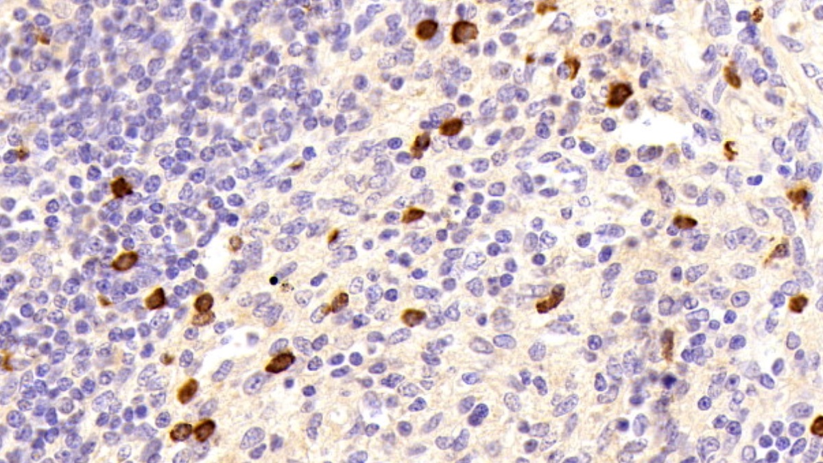 Polyclonal Antibody to Cystatin A (CSTA)