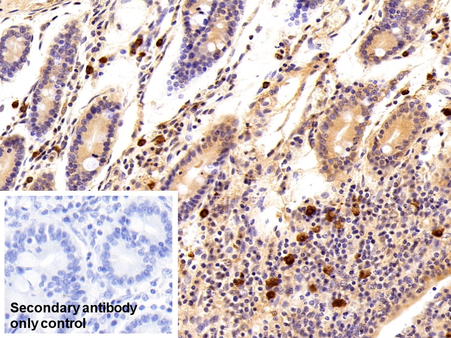 Polyclonal Antibody to Cystatin A (CSTA)