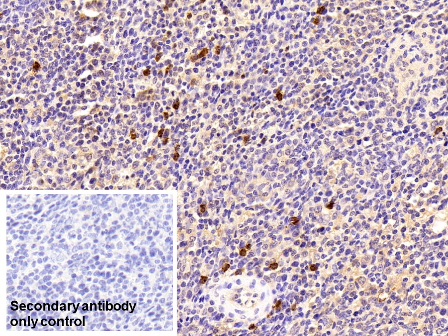 Polyclonal Antibody to Cystatin A (CSTA)