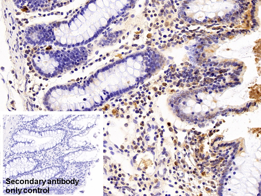 Polyclonal Antibody to Cystatin A (CSTA)