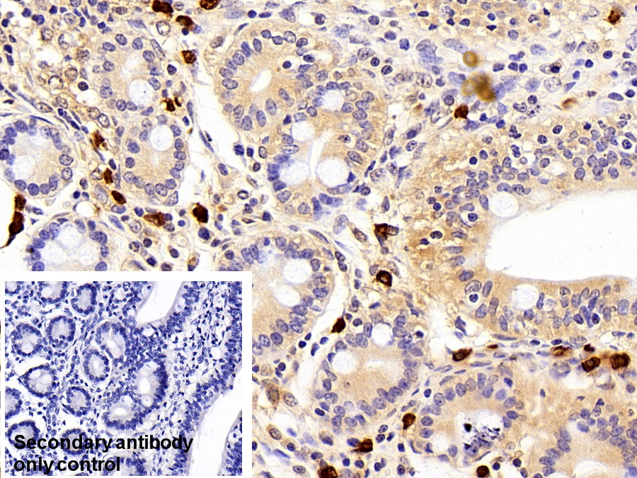 Polyclonal Antibody to Cystatin A (CSTA)