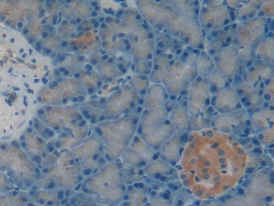 Polyclonal Antibody to Cystatin A (CSTA)