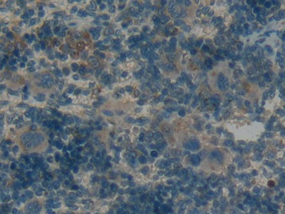 Polyclonal Antibody to Cystatin A (CSTA)