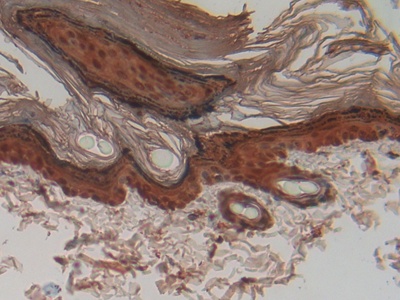 Polyclonal Antibody to Cystatin A (CSTA)