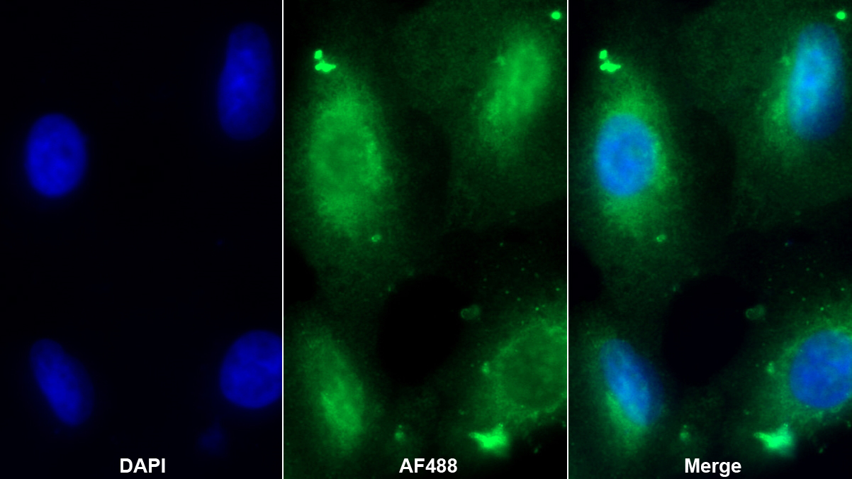 Polyclonal Antibody to Stromal Cell Derived Factor 2 (SDF2)