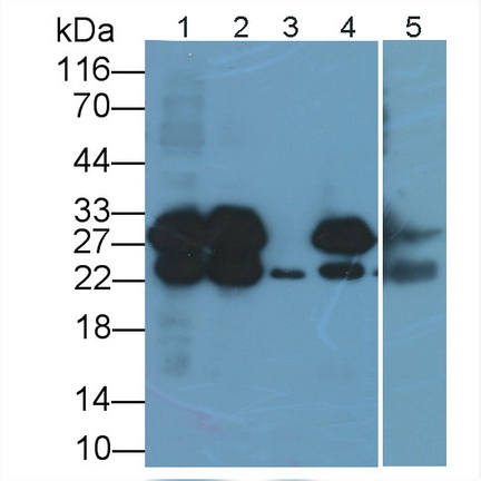 Polyclonal Antibody to Cardiac Troponin I (cTnI)