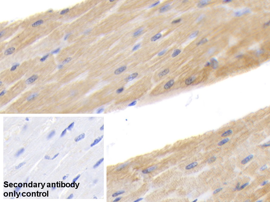 Polyclonal Antibody to Cardiac Troponin I (cTnI)