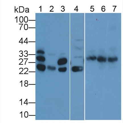 Polyclonal Antibody to Cardiac Troponin I (cTnI)