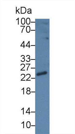 Polyclonal Antibody to Cardiac Troponin I (cTnI)