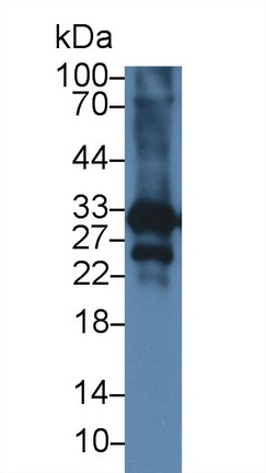 Polyclonal Antibody to Cardiac Troponin I (cTnI)