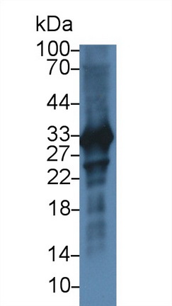 Polyclonal Antibody to Cardiac Troponin I (cTnI)