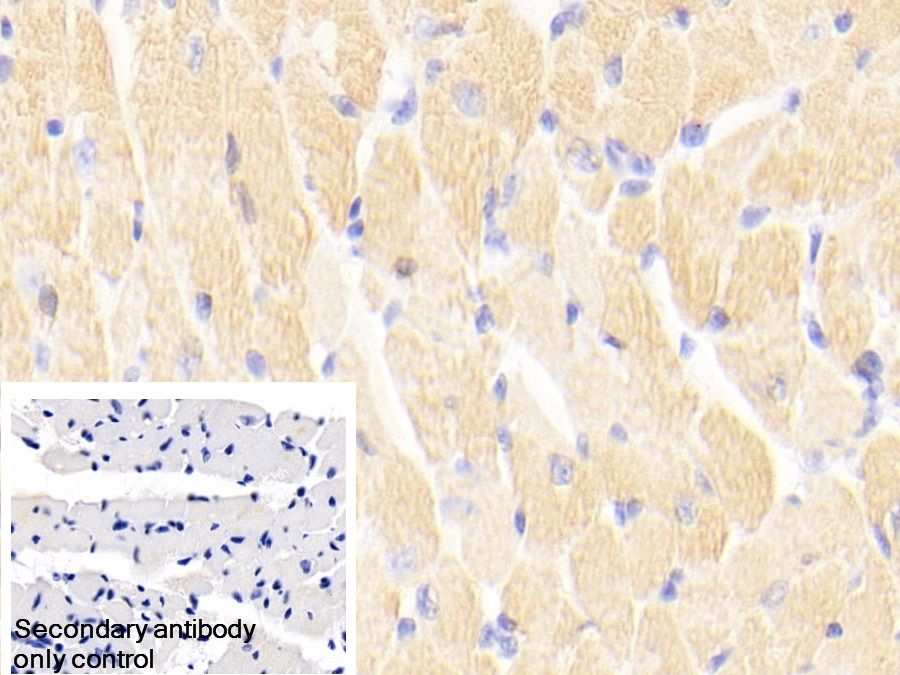 Polyclonal Antibody to Cardiac Troponin I (cTnI)