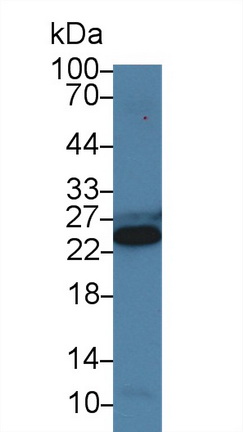 Polyclonal Antibody to Cardiac Troponin I (cTnI)