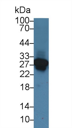 Polyclonal Antibody to Cardiac Troponin I (cTnI)