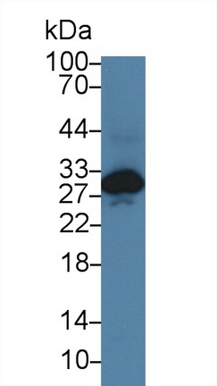 Polyclonal Antibody to Cardiac Troponin I (cTnI)