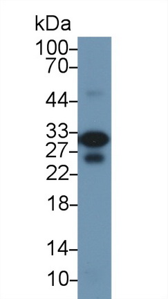 Polyclonal Antibody to Cardiac Troponin I (cTnI)