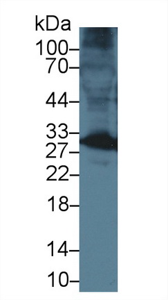 Polyclonal Antibody to Cardiac Troponin I (cTnI)