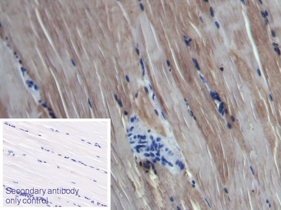 Polyclonal Antibody to Myoglobin (MYO)