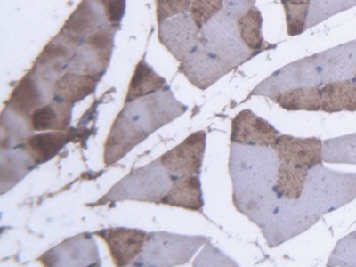 Polyclonal Antibody to Myoglobin (MYO)