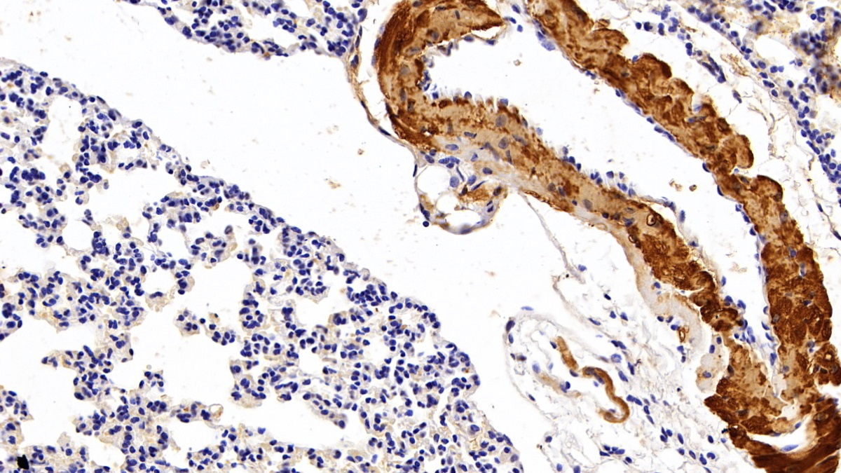 Polyclonal Antibody to Myoglobin (MYO)