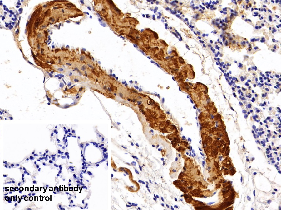 Polyclonal Antibody to Myoglobin (MYO)