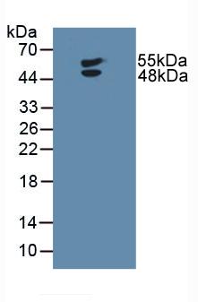 Polyclonal Antibody to Lymphotoxin Beta Receptor (LTbR)