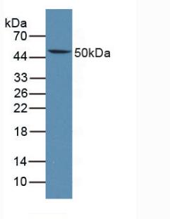 Polyclonal Antibody to Lymphotoxin Beta Receptor (LTbR)