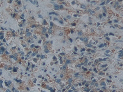 Polyclonal Antibody to Endothelin Converting Enzyme 1 (ECE1)