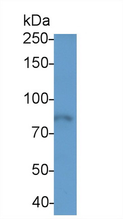 Polyclonal Antibody to Endothelin Converting Enzyme 1 (ECE1)