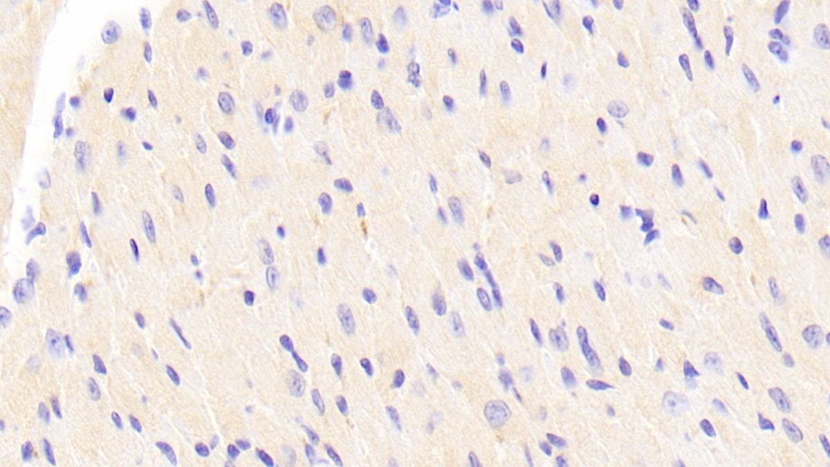 Polyclonal Antibody to N-Terminal Pro-Atrial Natriuretic Peptide (NT-ProANP)