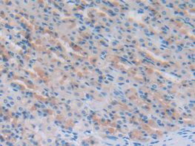 Polyclonal Antibody to N-Terminal Pro-Atrial Natriuretic Peptide (NT-ProANP)