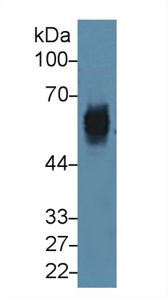 Polyclonal Antibody to Cytokeratin 5 (CK5)