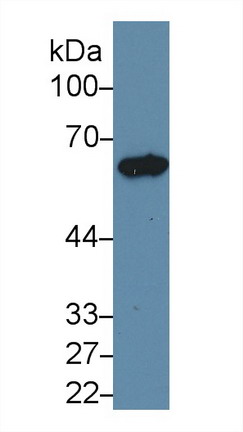 Polyclonal Antibody to Cytokeratin 5 (CK5)