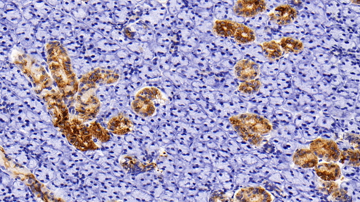 Polyclonal Antibody to Cytokeratin 5 (CK5)