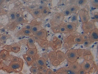 Polyclonal Antibody to Cytokeratin 4 (CK4)