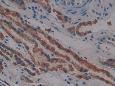 Polyclonal Antibody to Cytokeratin 4 (CK4)