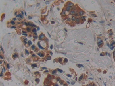 Polyclonal Antibody to Cytokeratin 4 (CK4)