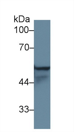 Polyclonal Antibody to Cytokeratin 4 (CK4)