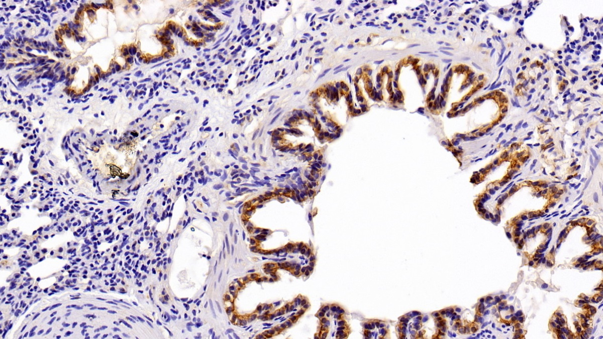 Polyclonal Antibody to Cytokeratin 4 (CK4)