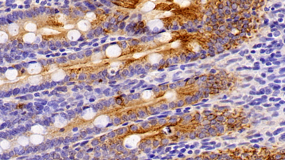 Polyclonal Antibody to Cytokeratin 4 (CK4)